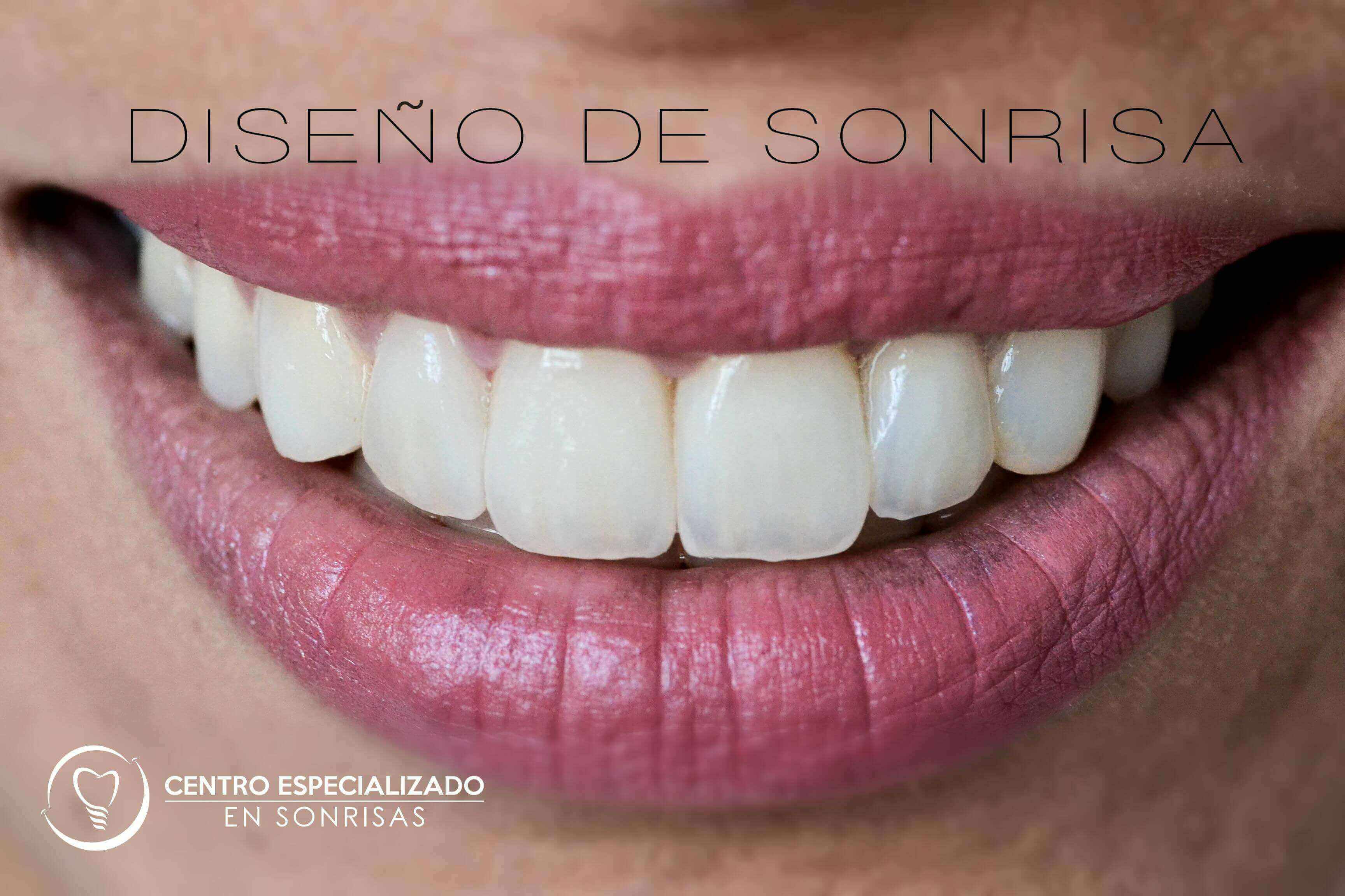 Dise O De Sonrisas Sabes Realmente En Qu Consiste