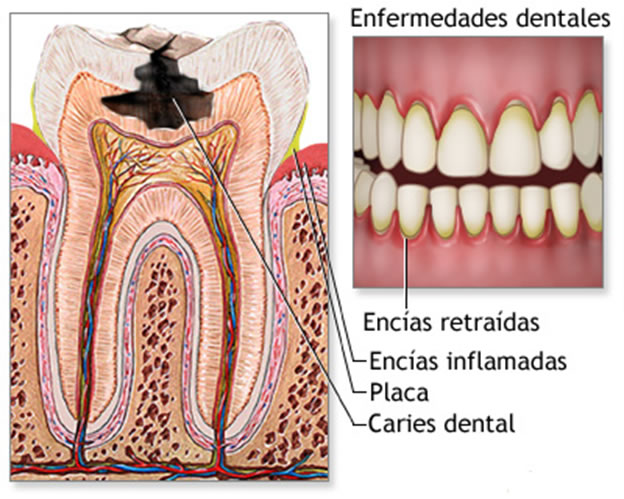 tipo de enfermedades dentales