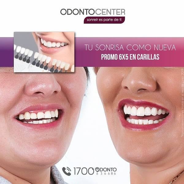 Aprovecha estas increíbles promociones para que tengas tu sonrisa perfecta y hermosa!