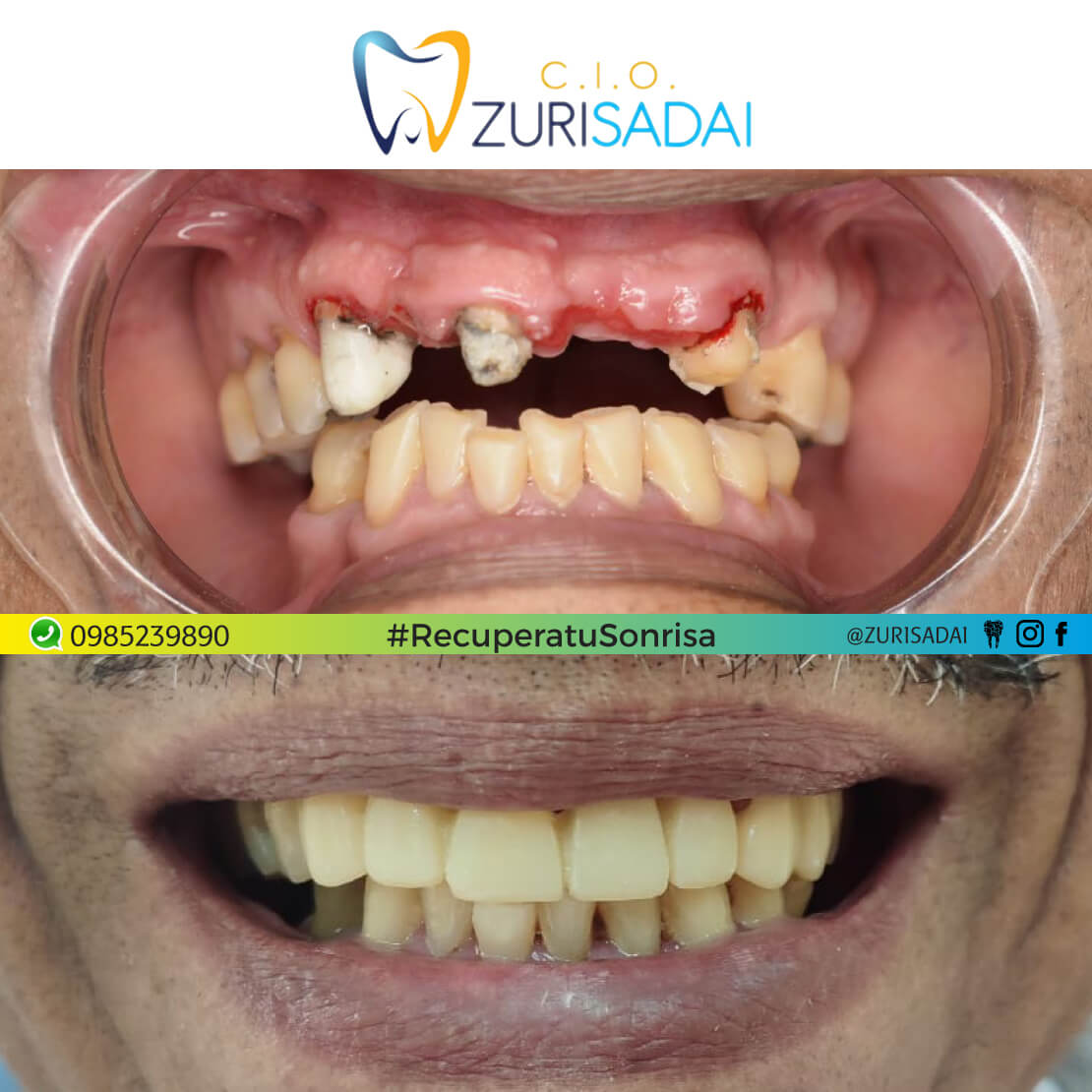 👉🏼 Luce una nueva sonrisa en manos de Especialistas😁 