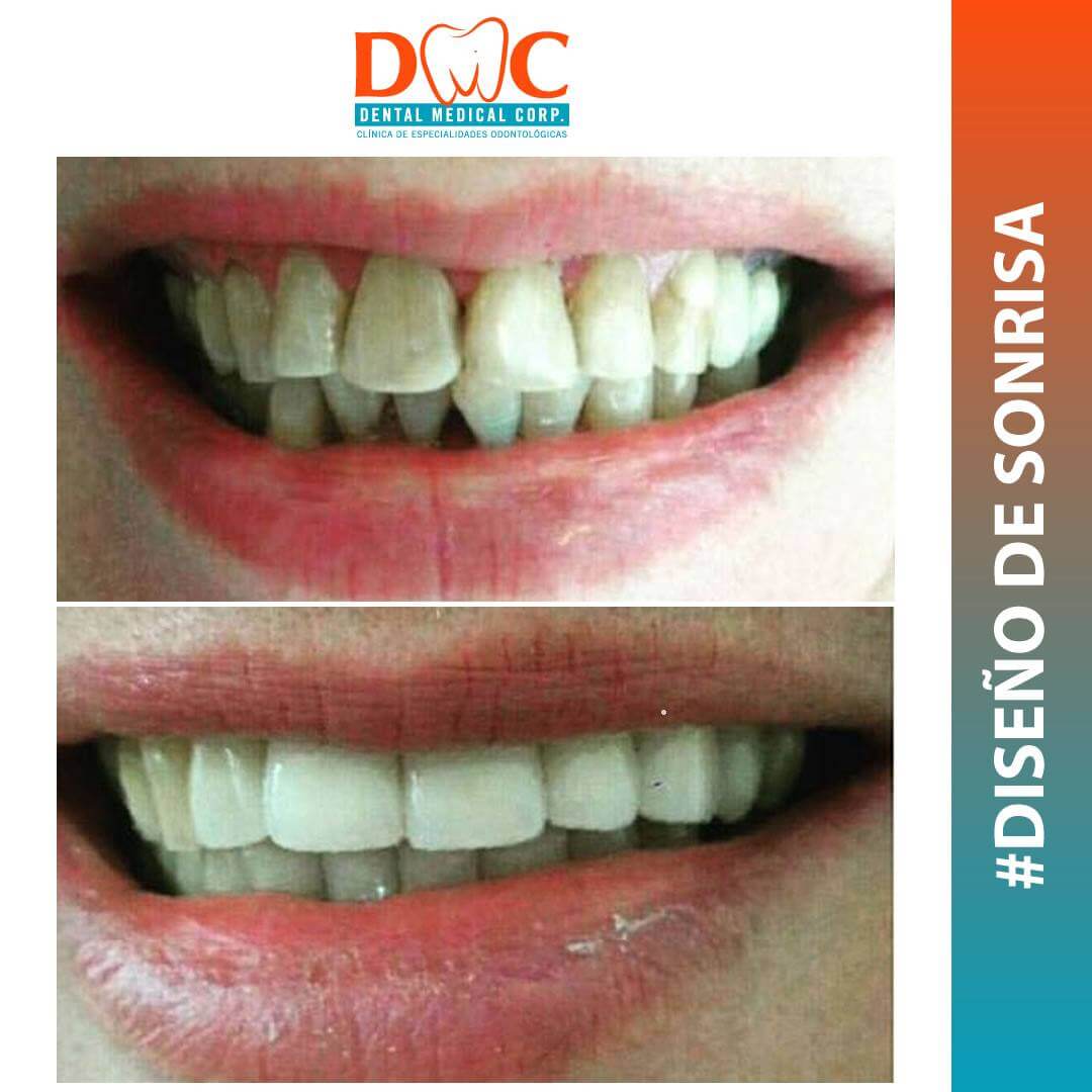 Disfrutar de una hermosa sonrisa 🤩 con Dental Medical Corp