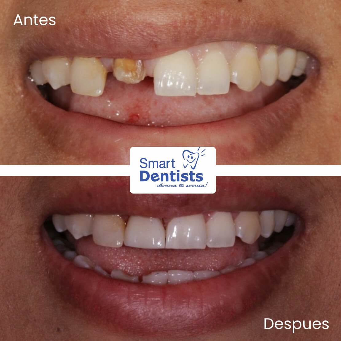 CON DIENTES O SIN DIENTES?? TU DECIDES!!