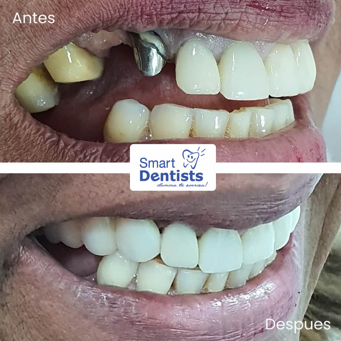 Con dientes o sin Dientes?? TU DECIDES!!