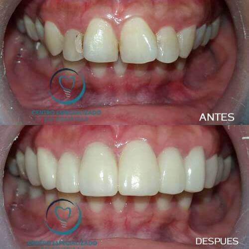 👉🏼 Cambia  tu apariencia y luce una hermosa sonrisa 😁