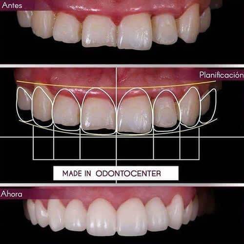 💫LUCE TU SONRISA ODONTOCENTER!