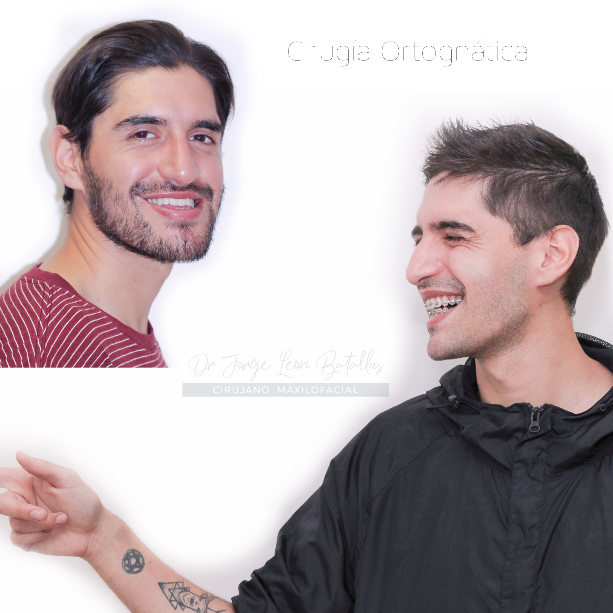 Cirugía Ortognática - La simetría facial