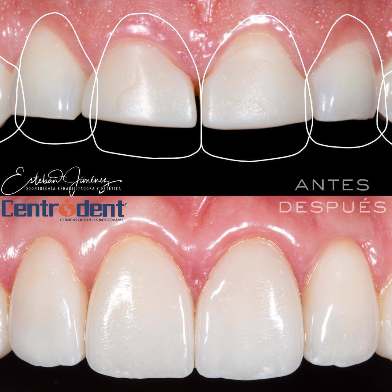 ¿Qué esperas para renovar tu sonrisa y tu estilo de vida? 