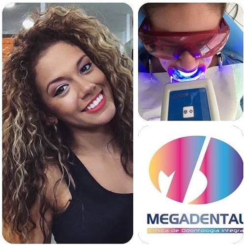 Blanqueamiento Dental | MEGADENTAL