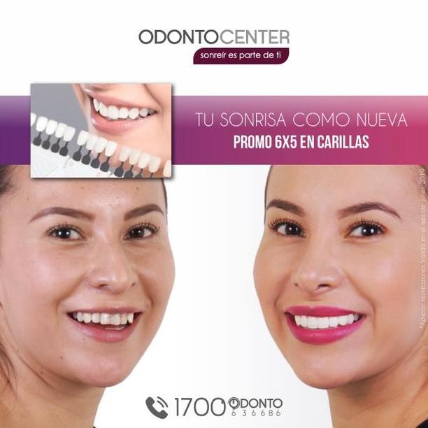 NUEVAS PROMOS! En Junio te sorprendemos con estas increíbles promociones | sonrisa hermosas