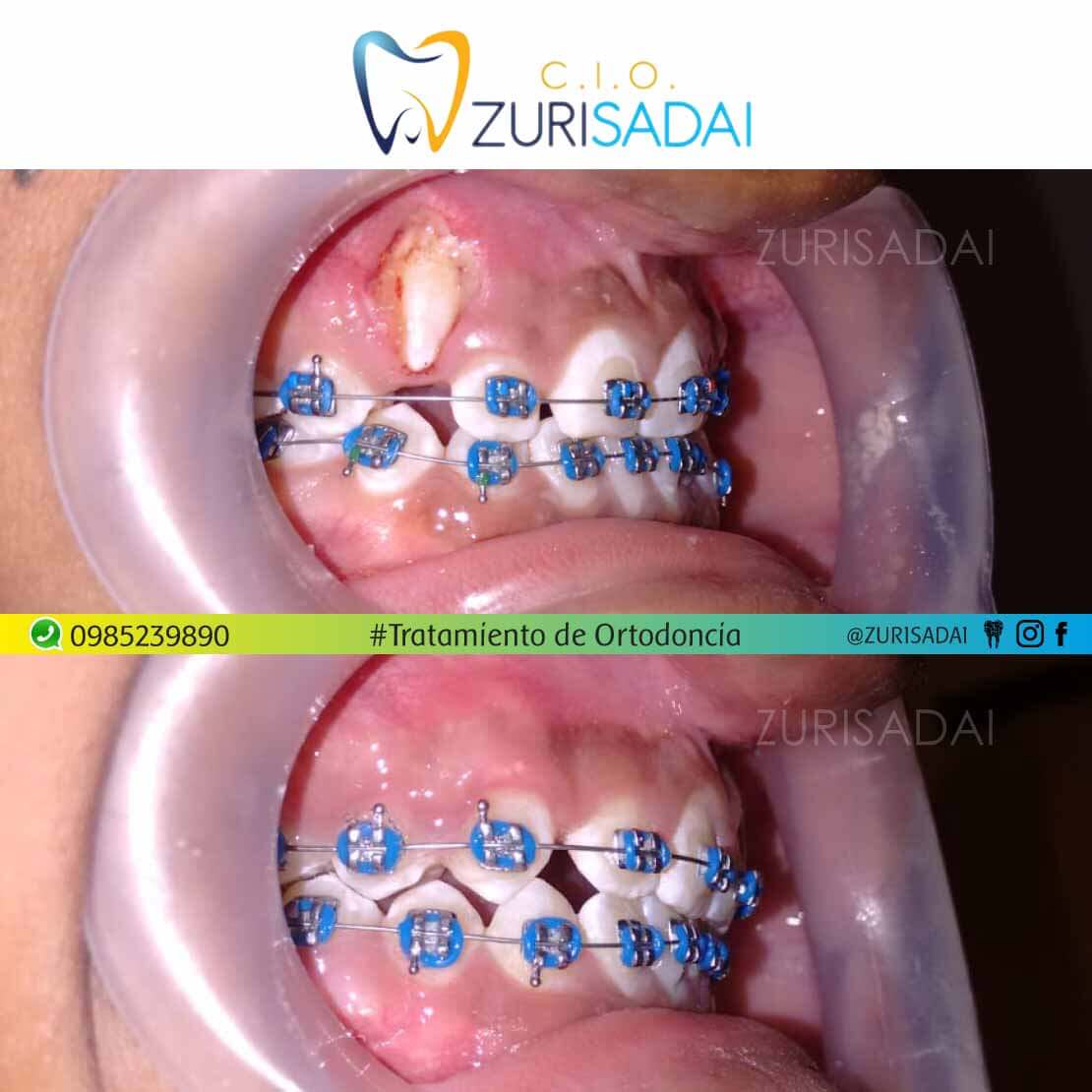 👉🏼 Cambia  tu apariencia y luce una nueva sonrisa 😁 con Ortodoncia