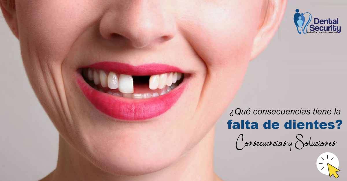 ¿Qué consecuencias tiene la falta de dientes?