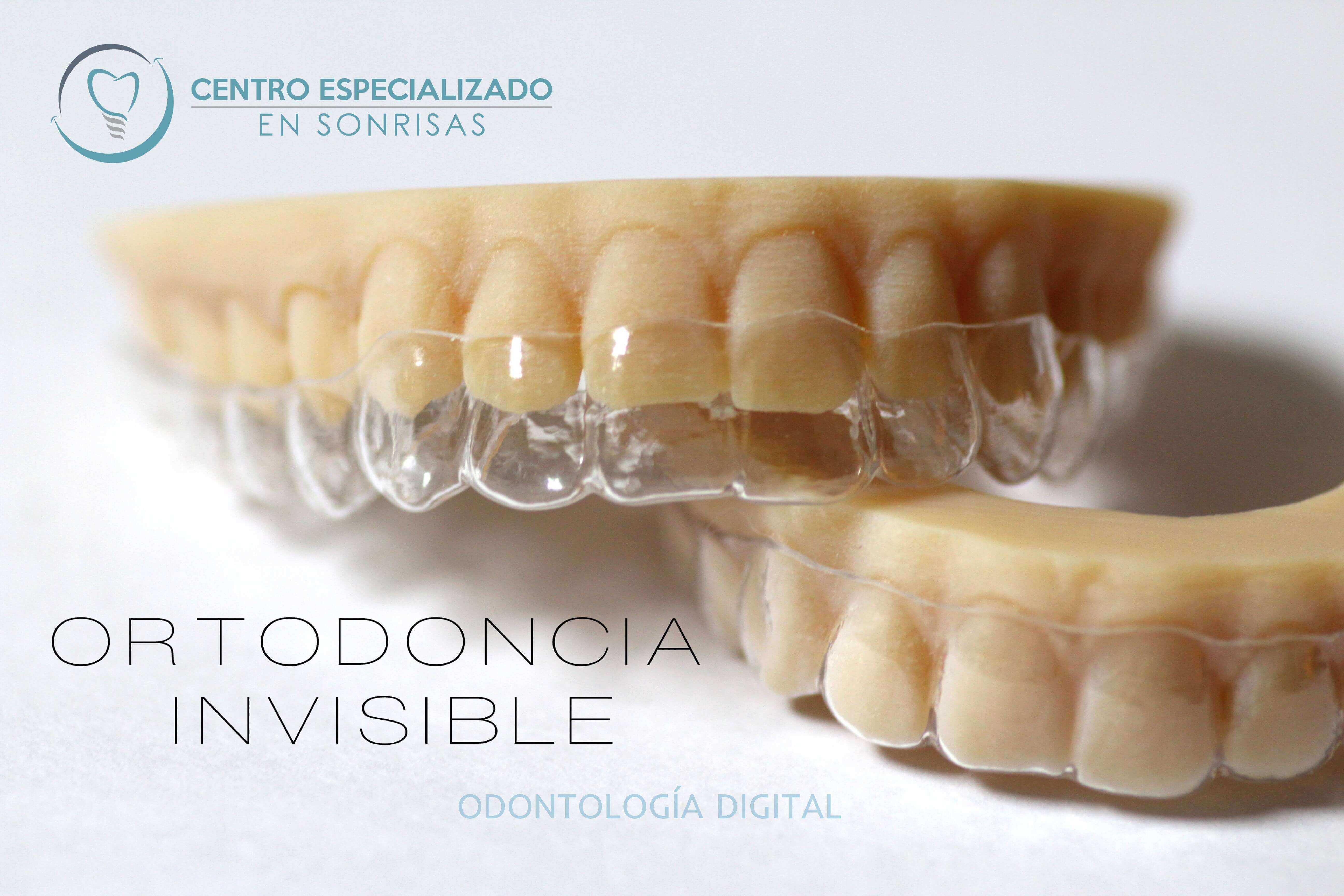 Odontologia Digital - Ortodoncia Invisible