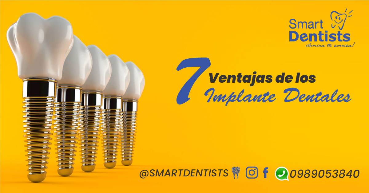 7 ventajas de los implantes dentales