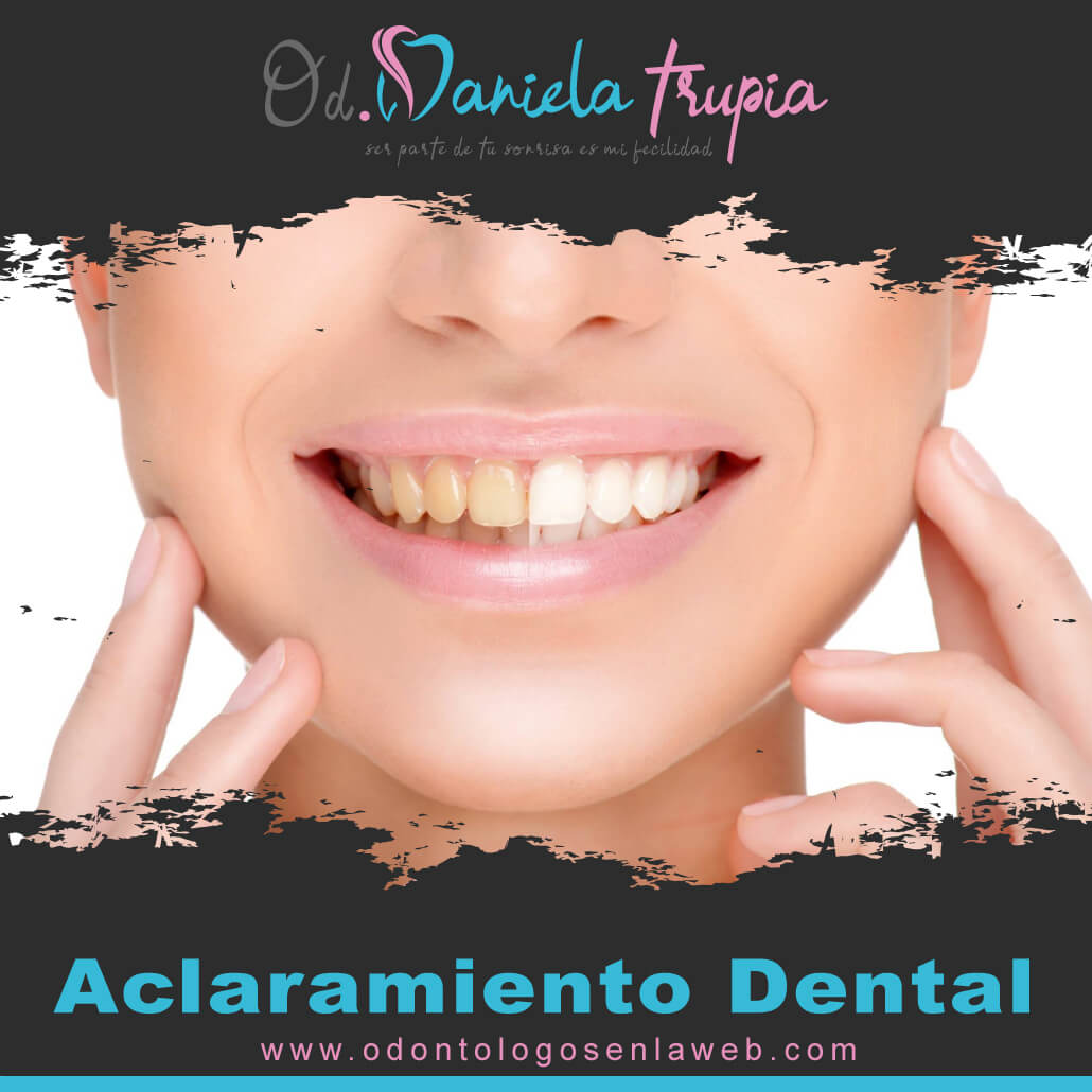 Tratamiento de Blanqueamiento Dental