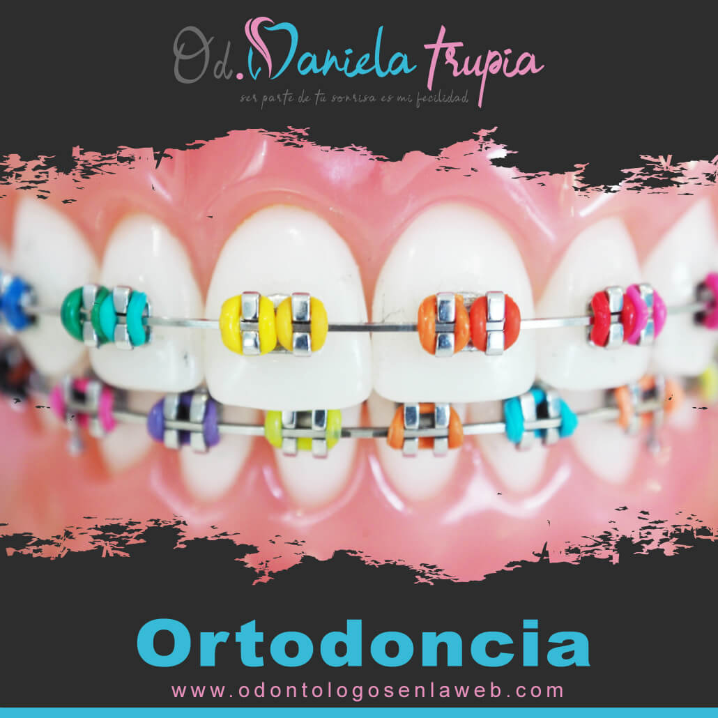 Tratamiento de Ortodoncia