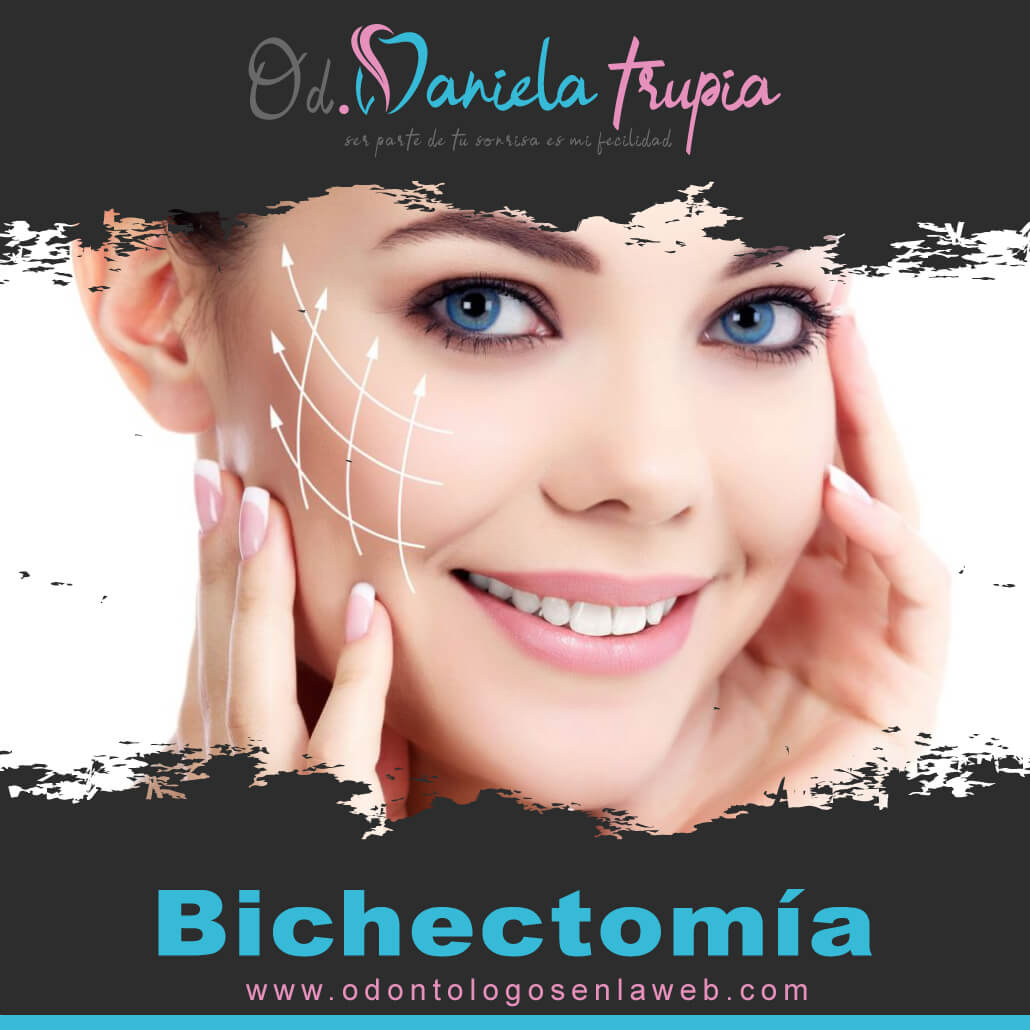 Tratamiento de Bichectomia (Reducción de mejillas)