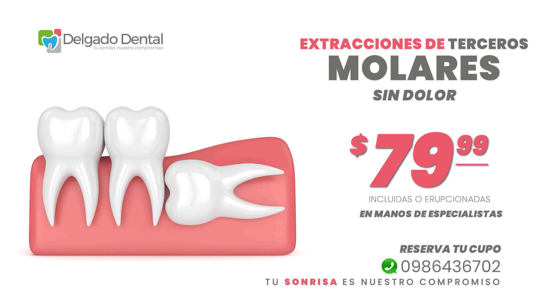 Promoción Extracción de Terceros Molares (Incluidas o Erupcionadas) por $79,99 ✅