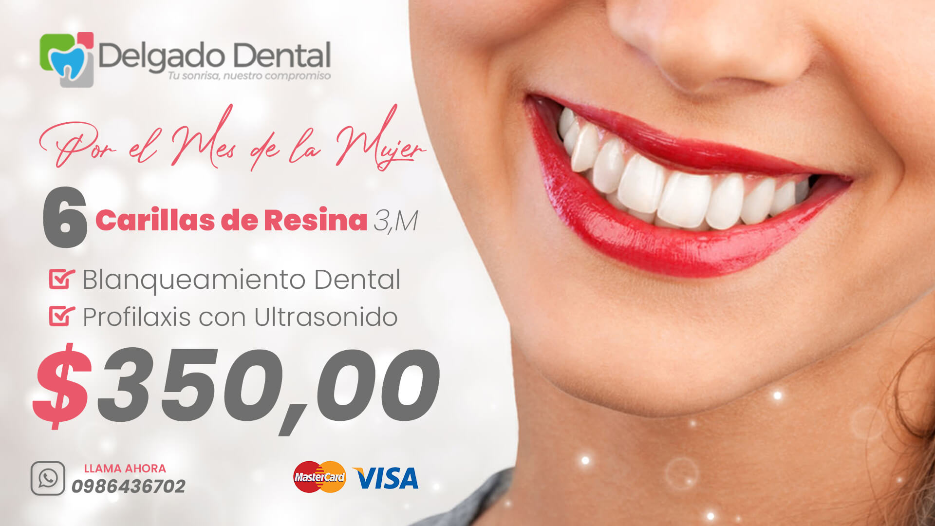 Por el Mes de la Mujer👉 No te pierdas nuestra promoción en Carillas Dentales.