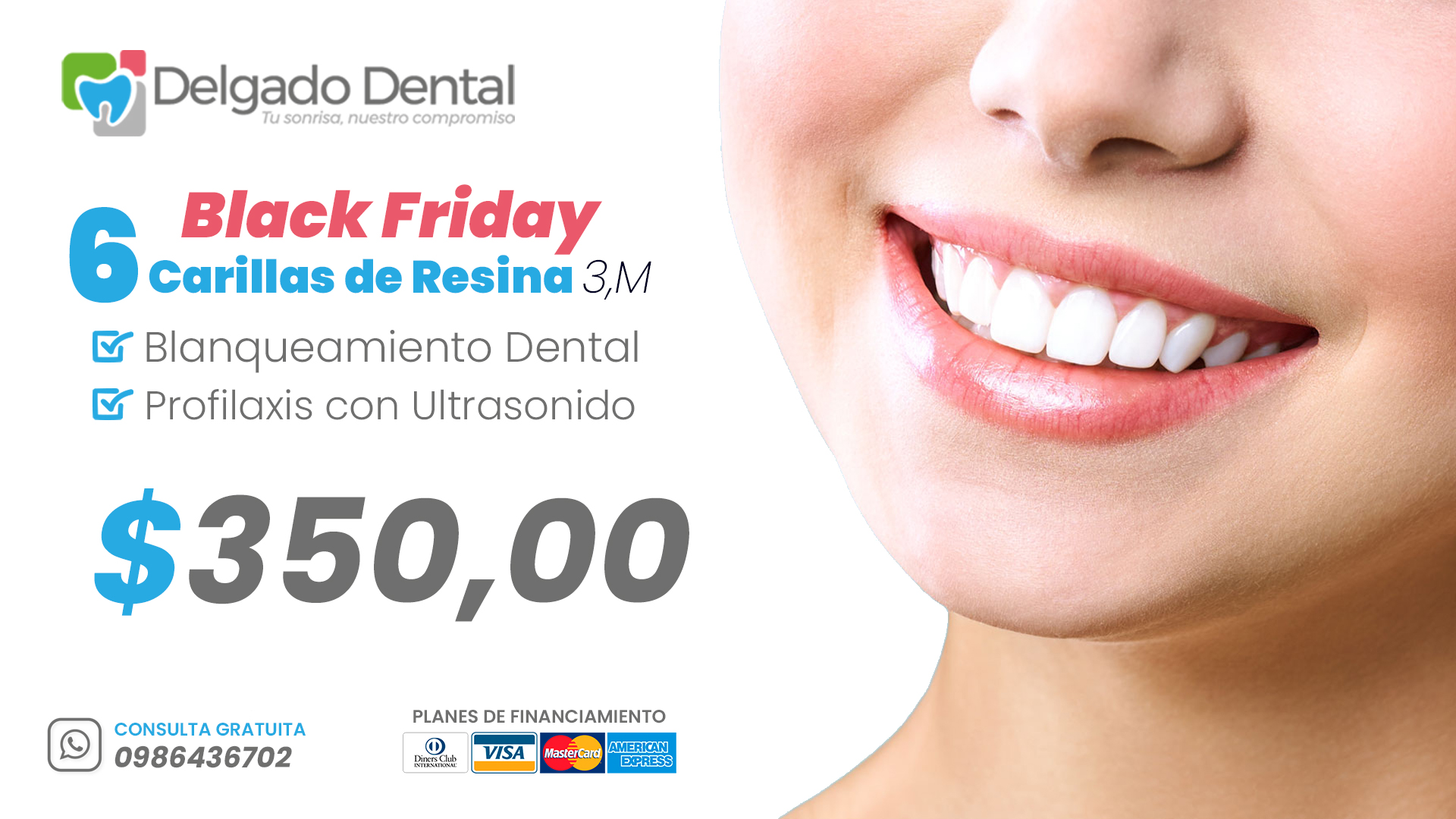 No pierdas esta oportunidad ✅  en este BLACK FRIDAY traemos para ti Diseño de Sonrisa 😁 6 Carillas de Resina de alta estética