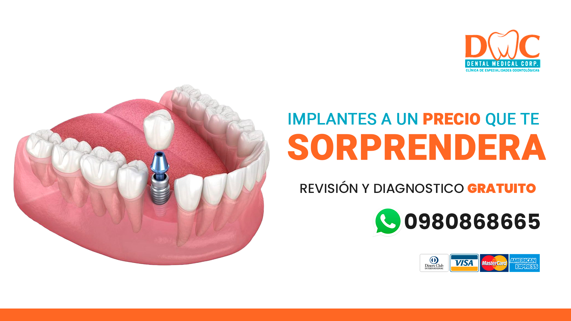 Revisión y Diagnósticos Gratuito ✨ EN IMPLANTES DENTALES