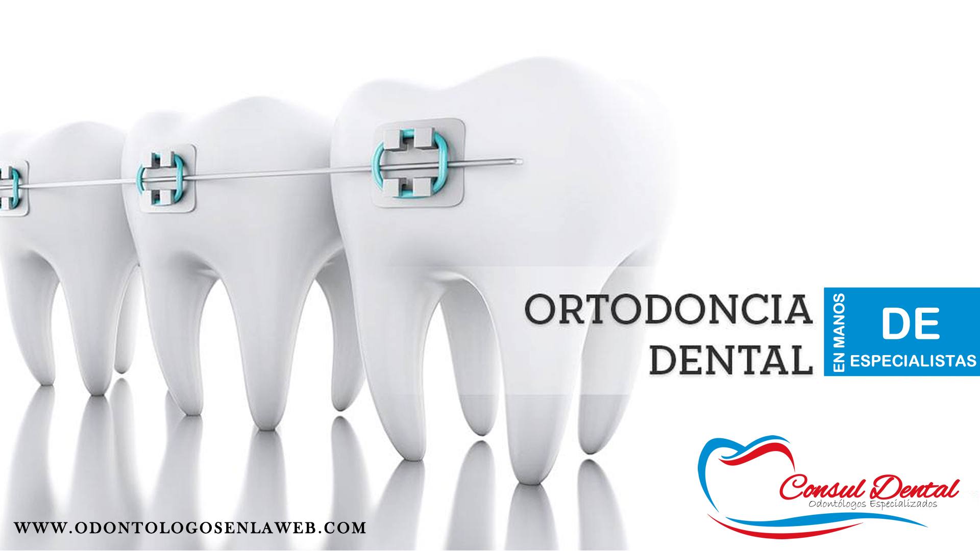 Conoce Todas Las Promociones Dentales En Odontólogos En La Web 8104