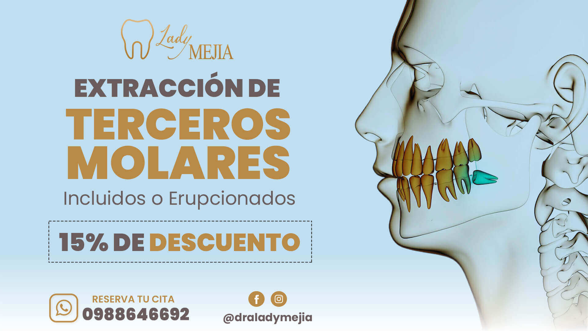 👉Extracción de Terceros Molares con el 15% de DESCUENTO 🦷