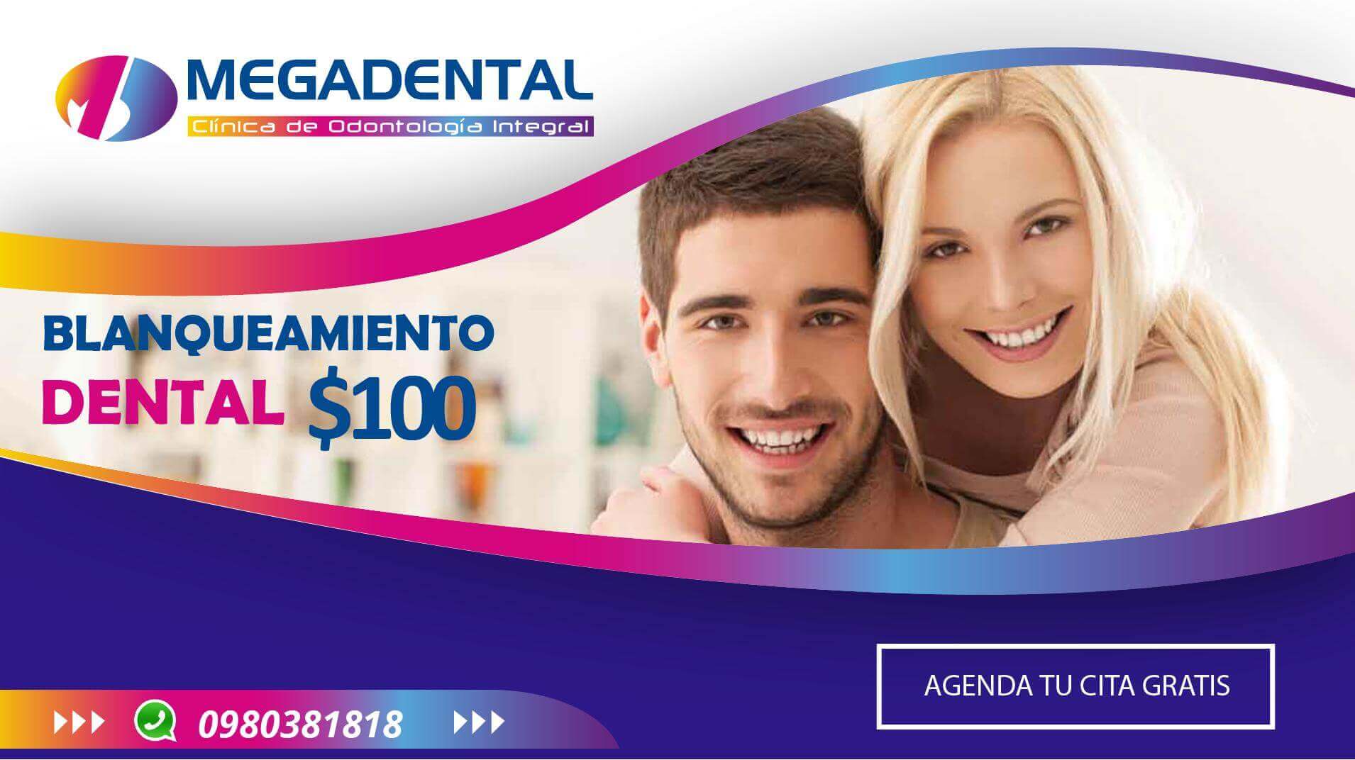 BRILLA CON TU SONRISA 👍🏻 Blanqueamiento Dental por $100