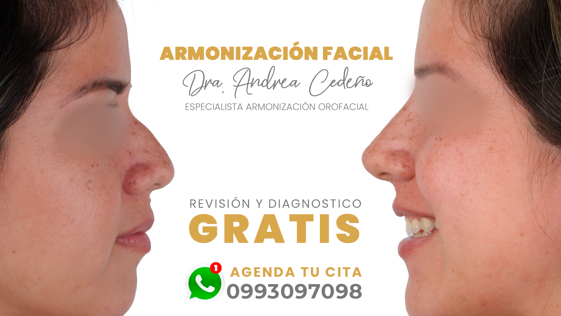 Revisión y Diagnósticos Gratuito ✨ Armonización Facial