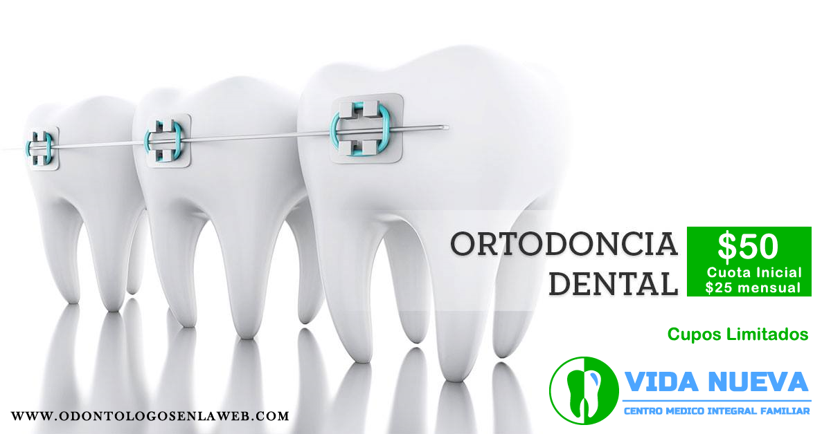 Ortodoncia Dental Cuota Inicial $50 Mensual $25