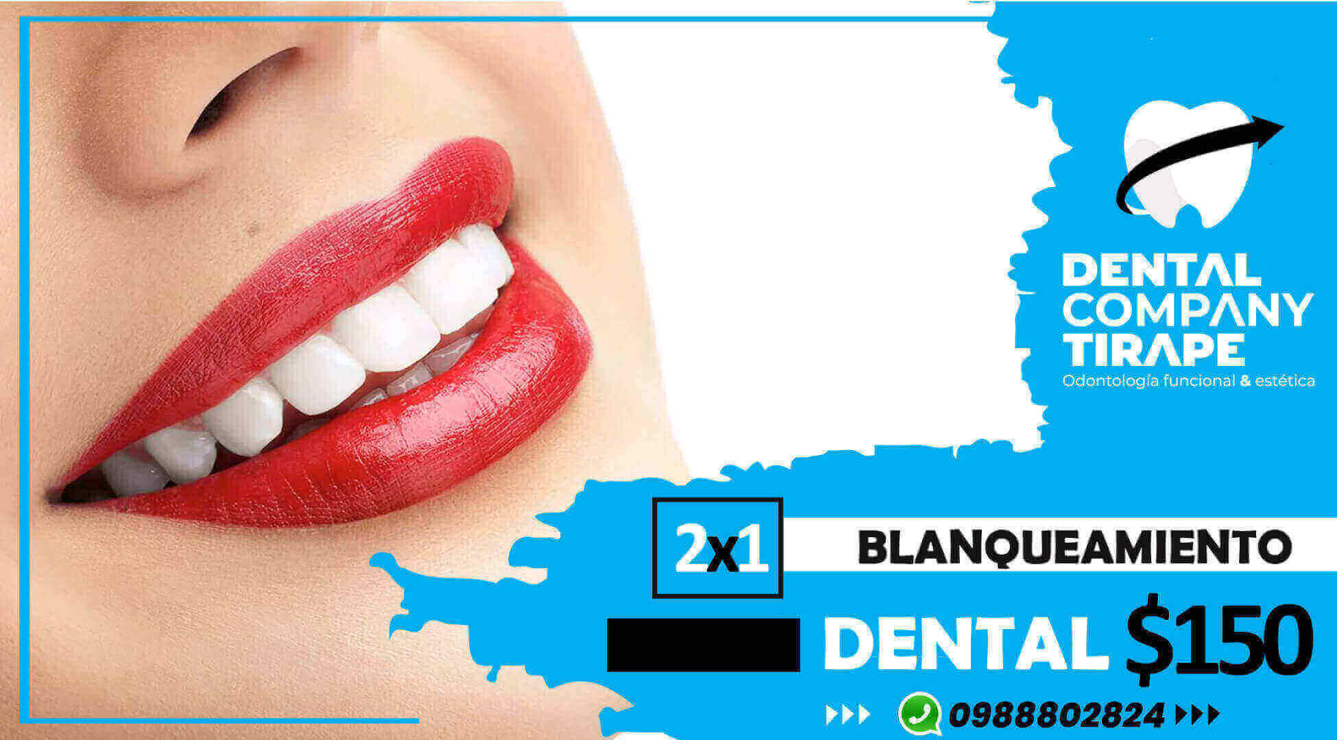 🤩 DALE UN CAMBIO BRILLANTE A TU SONRISA!  😃✨ ▷ 2X1 BLANQUEAMIENTO DENTAL POR📣 $150