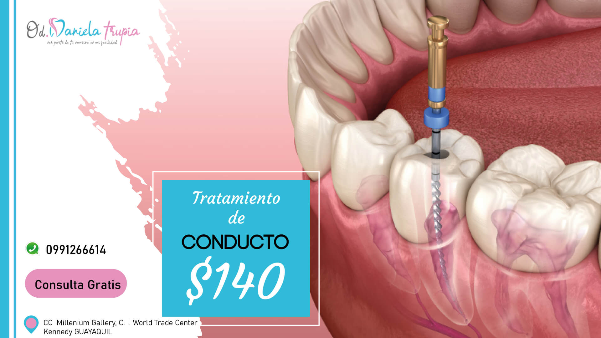 ¿Tienes caries que no ha sido tratada a tiempo y te causan ya dolor? Contáctanos y daremos solución