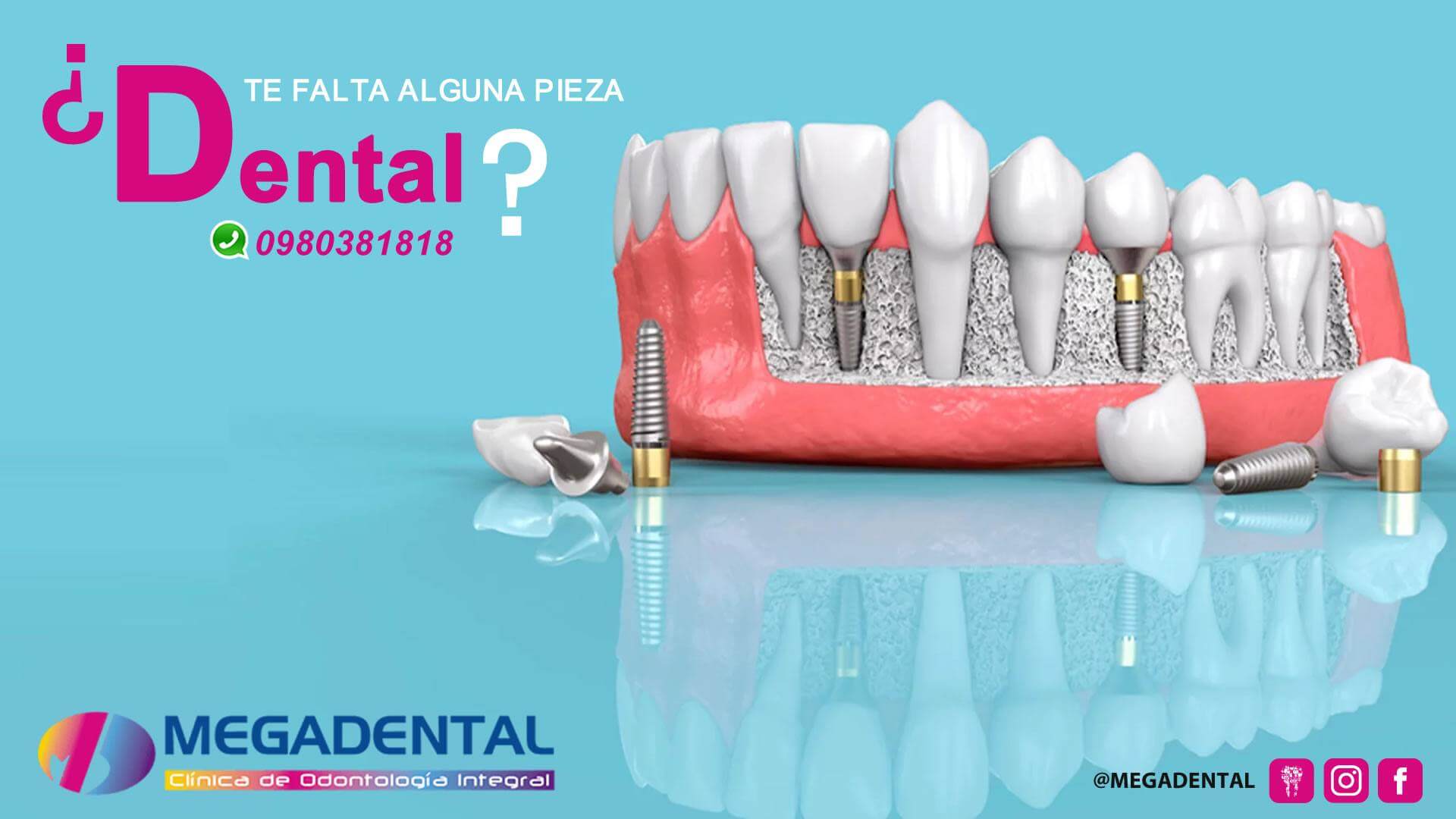 ¿TE FALTA ALGUNA PIEZA DENTAL?